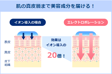 イオン導入のエレクトロポレーションについての画像